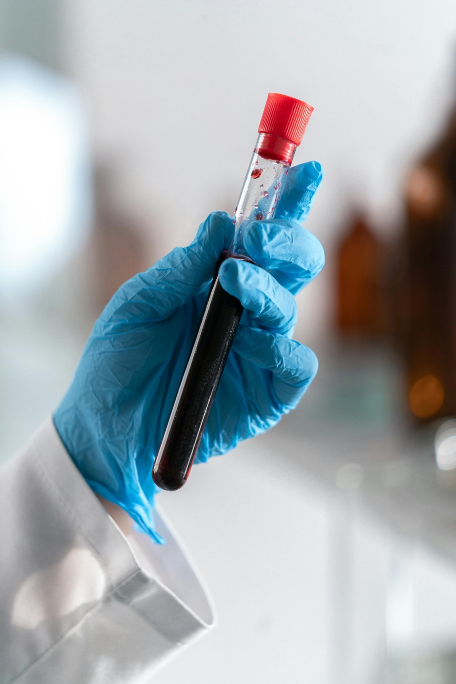 Lab Test